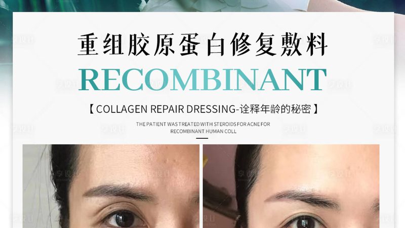 瘦脸面罩与V脸提拉：效果对比解析