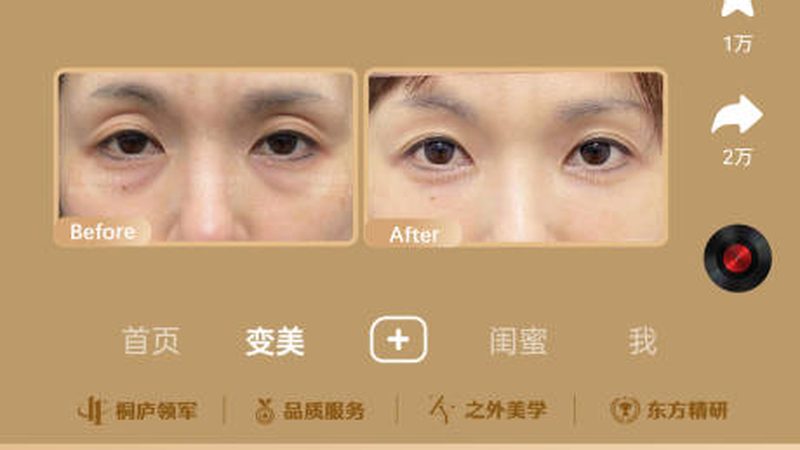 瘦脸操VS面部瑜伽：揭秘两种瘦脸方式的本质区别