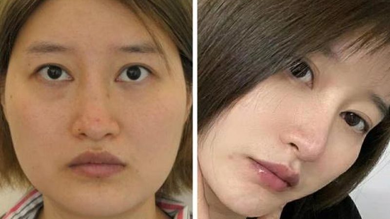 医美面膜与普通面膜：成分差异大揭秘
