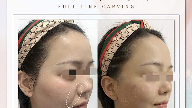 轻医美诊所注册流程：揭秘合规之路