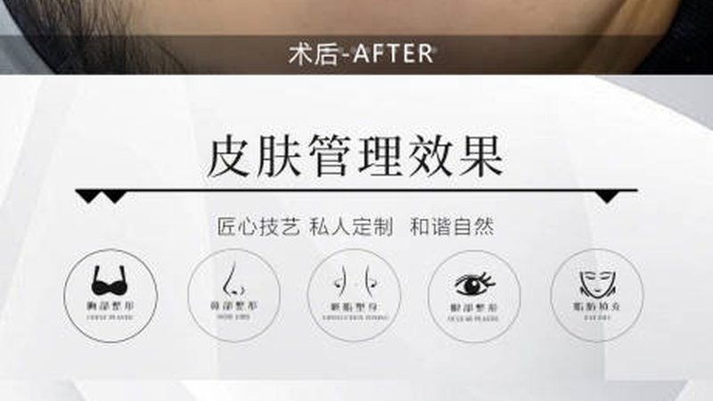 小标题：敏感肌的困扰