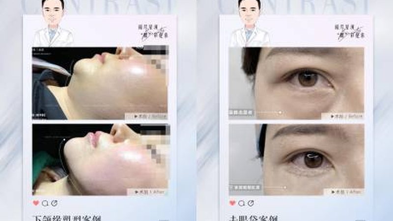 医疗美容科诊疗科目备案：揭秘背后的行业规范
