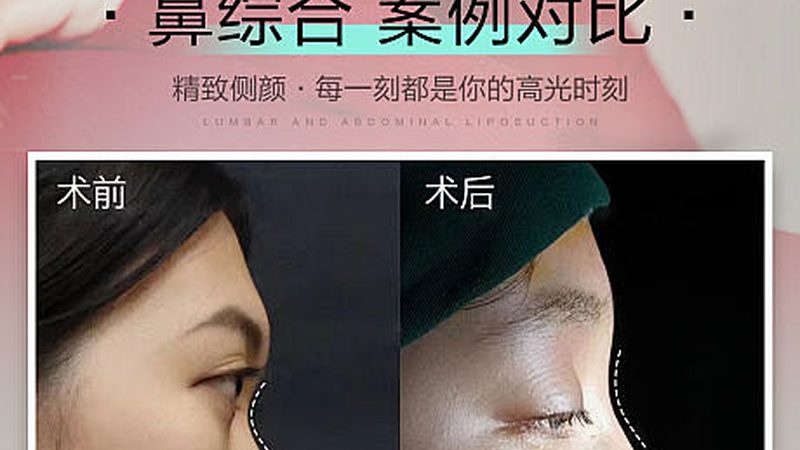 医美咨询师转行新媒体运营：转型攻略与关键技能