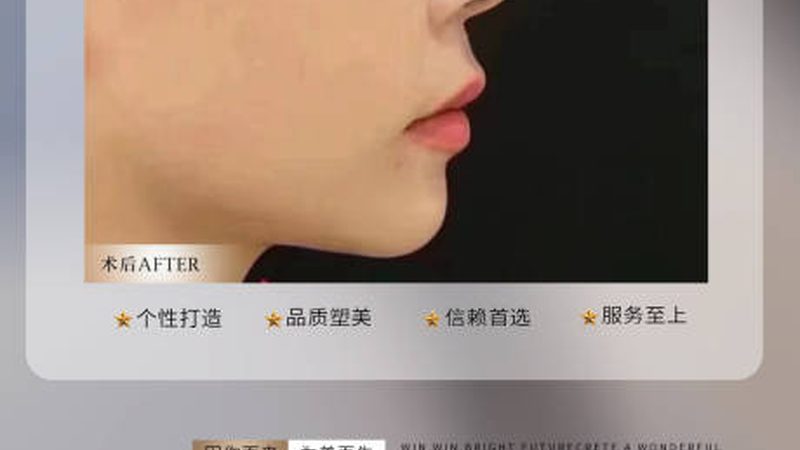 注射美容：揭秘禁忌症与适应症**