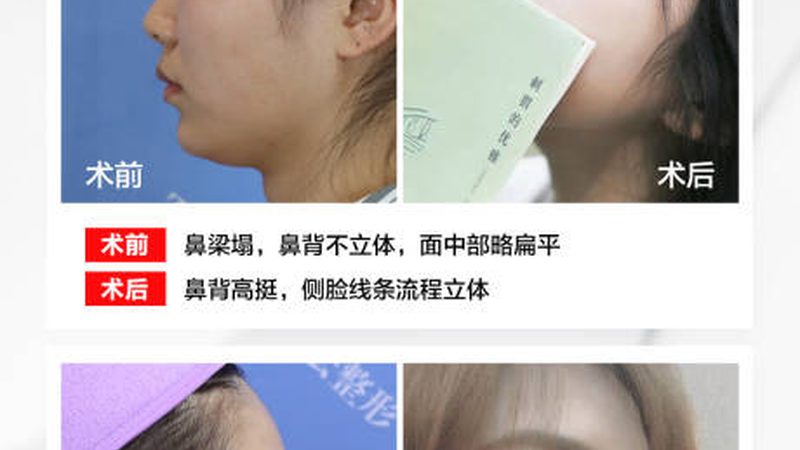 皮肤管理中心装修费用预算