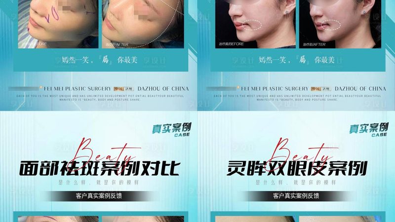 轻医美产品OEM定制，合同规范解析