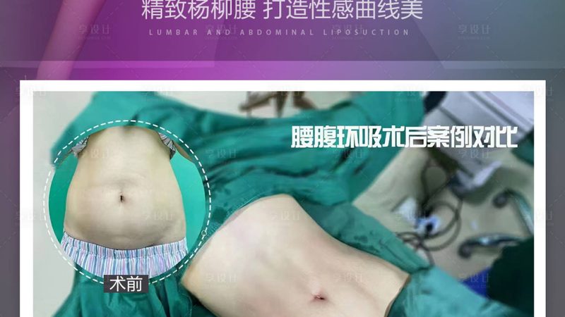射频仪与超声炮：紧致肌肤的科技较量