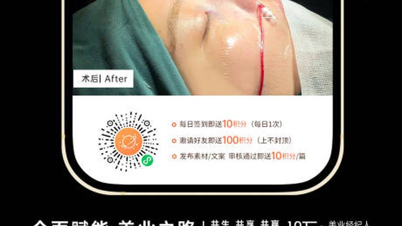 衡力肉毒素：揭秘其原理与注射技巧**