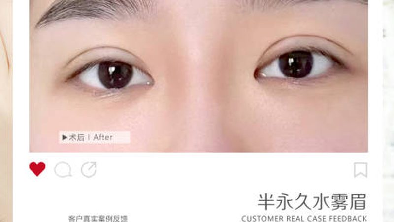 孕妇可以做注射美容吗？揭秘孕期美容的真相