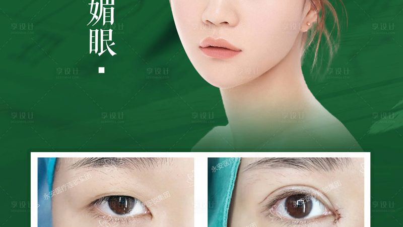 成都光子嫩肤设备采购