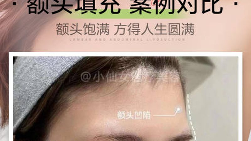 小标题：双眼皮贴导致松弛的原因
